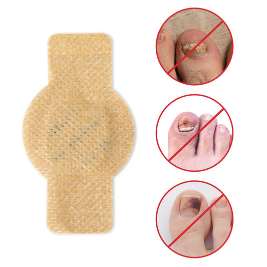 63 Anti Fungal Nail Treatment Patches Toe Fungus Onychomycosis Repair Sticker