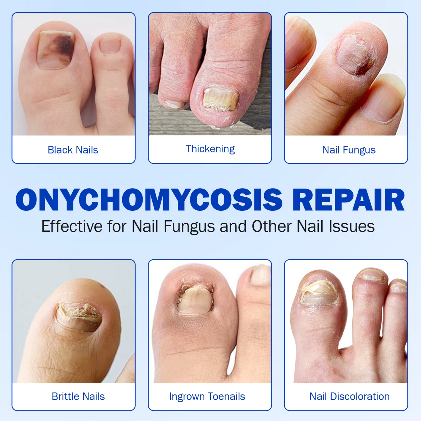 63 Anti Fungal Nail Treatment Patches Toe Fungus Onychomycosis Repair Sticker